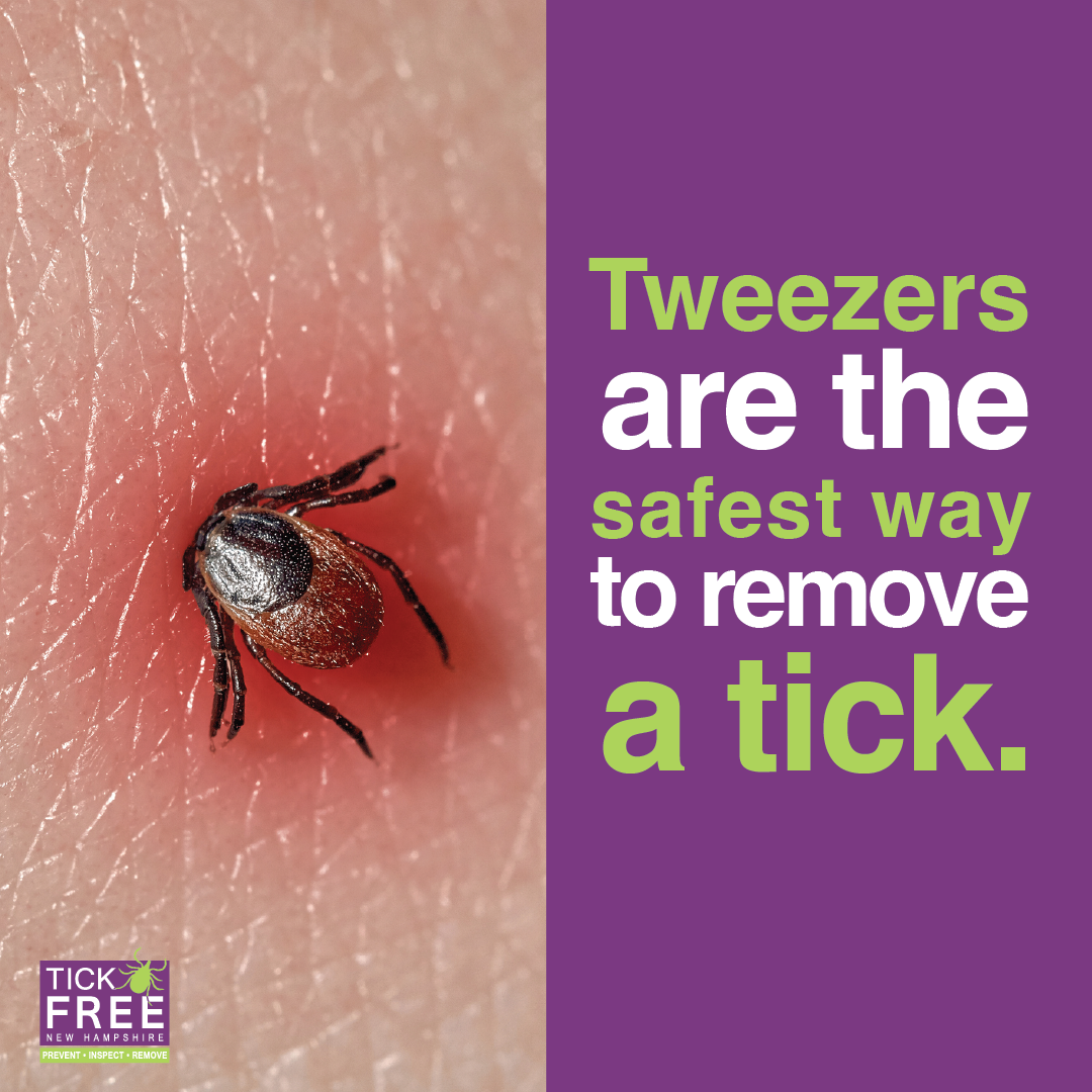 Tweezers are the safest way to remove a tick.